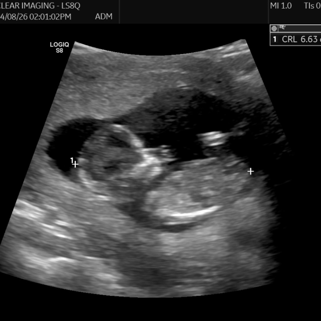Photo shared by Alexis for their Babylist baby registry.