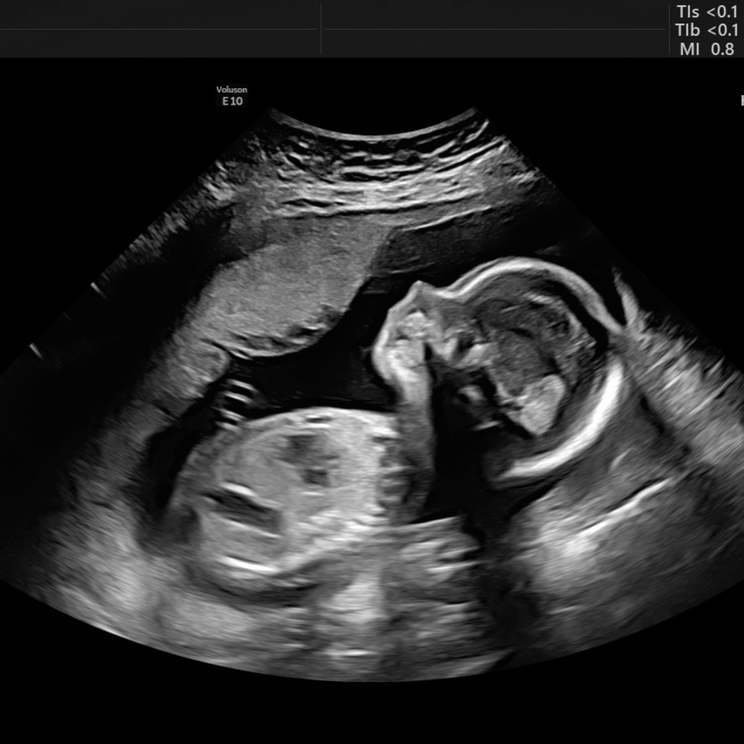 Photo shared by Holly for their Babylist baby registry.