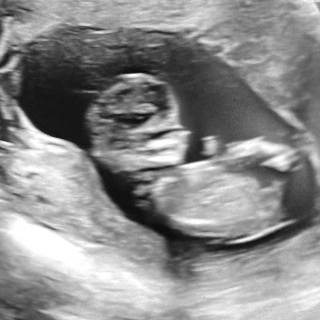 Photo shared by Yvonne for their Babylist baby registry.