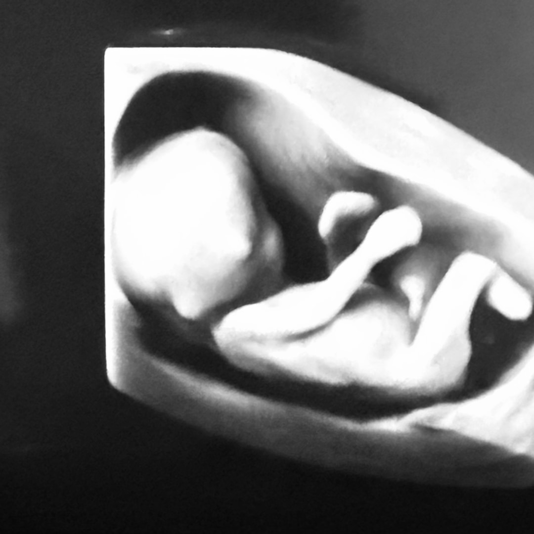 Photo shared by Brittni for their Babylist baby registry.