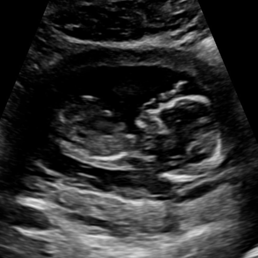 Photo shared by Karen for their Babylist baby registry.