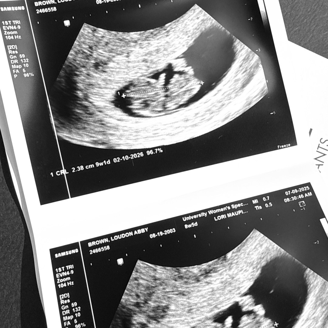 Photo shared by Abby for their Babylist baby registry.