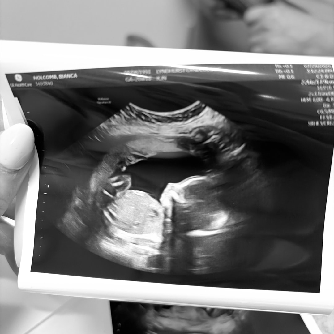 Photo shared by Bianca for their Babylist baby registry.
