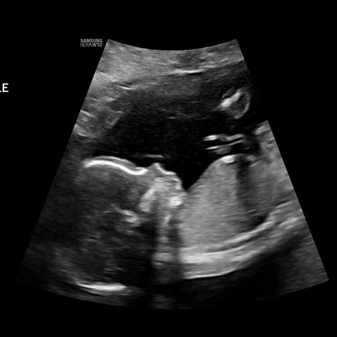 Photo shared by Hannah for their Babylist baby registry.