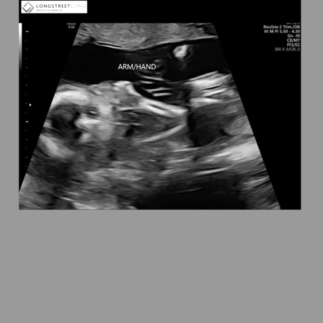 Photo shared by Heidy for their Babylist baby registry.