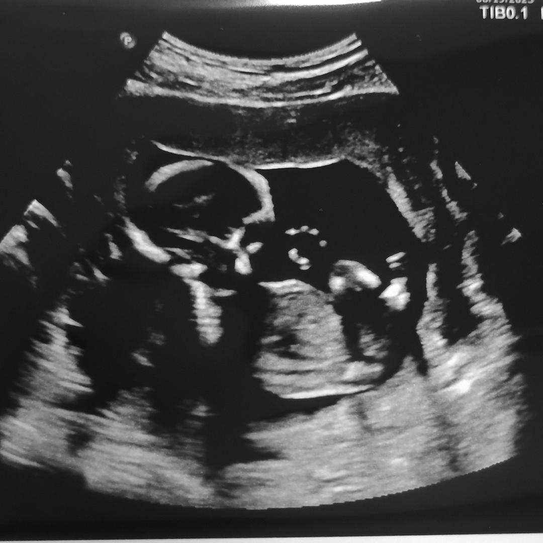 Photo shared by Lily for their Babylist baby registry.