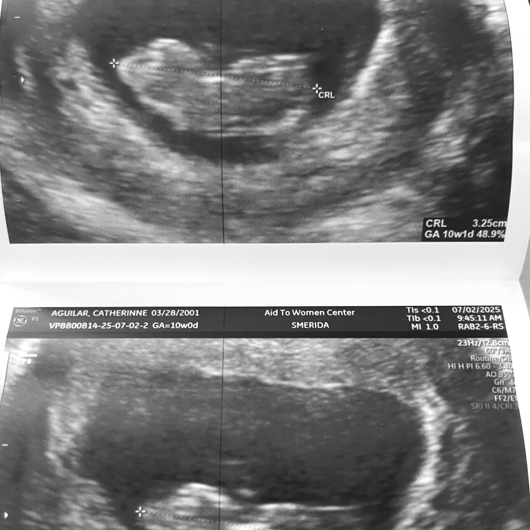 Photo shared by Catherinne for their Babylist baby registry.