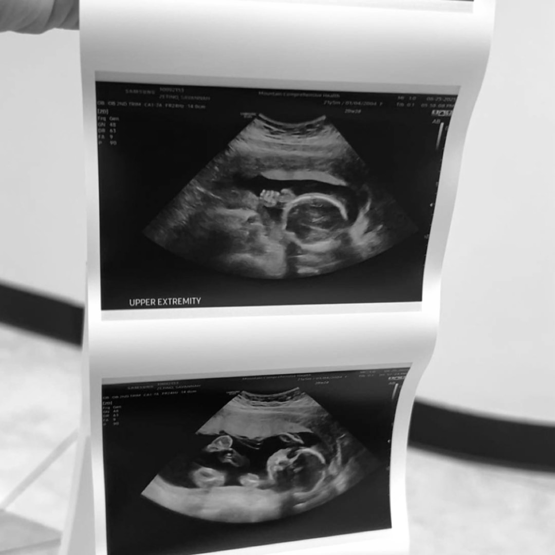 Photo shared by Savannah for their Babylist baby registry.