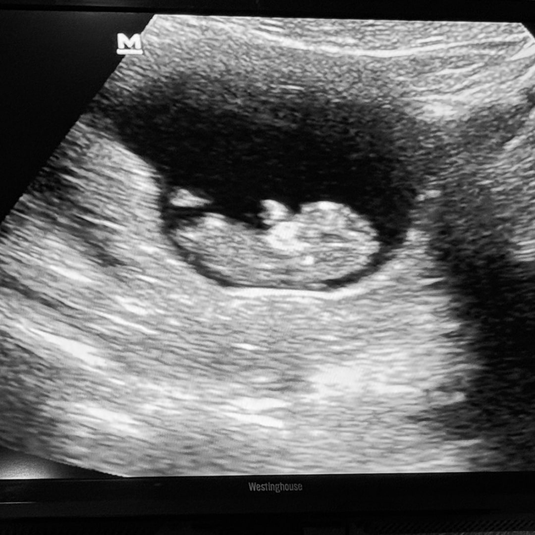 Photo shared by Arielle for their Babylist baby registry.