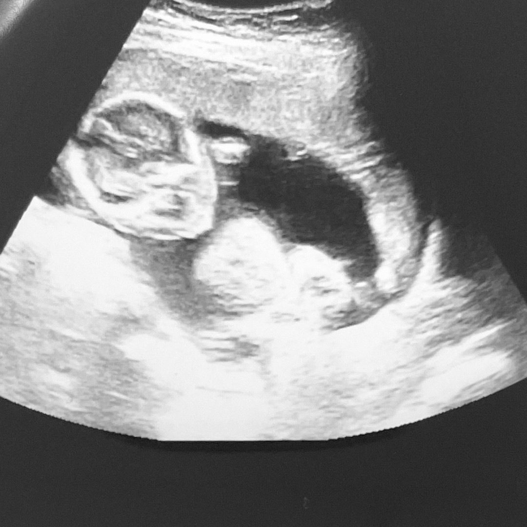 Photo shared by Cassandra for their Babylist baby registry.