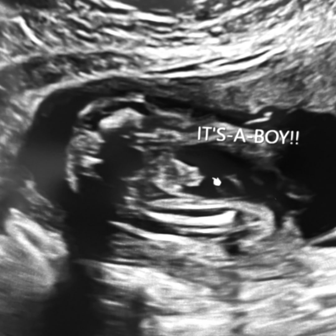 Photo shared by Kelly for their Babylist baby registry.