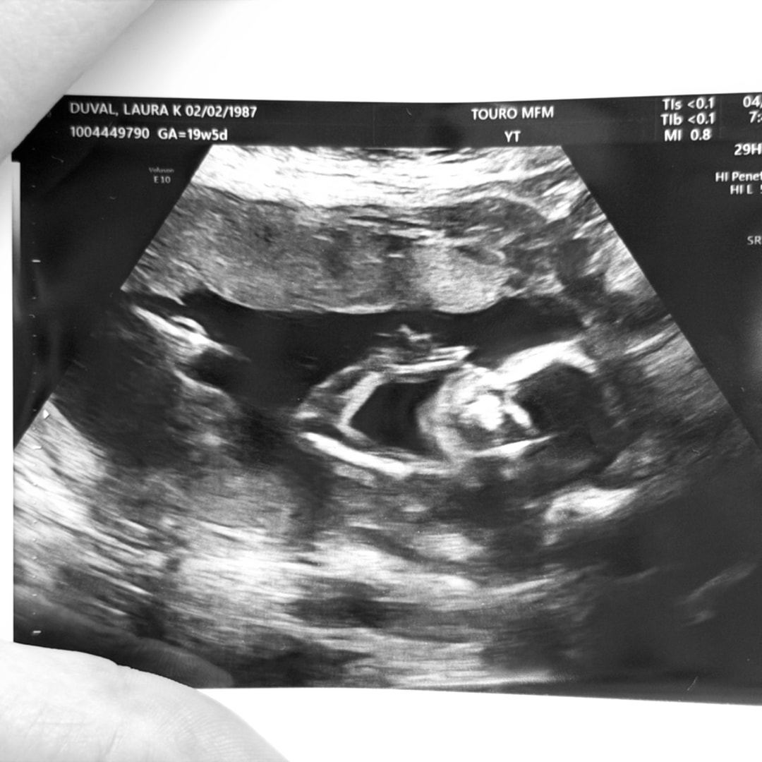 Photo shared by Laura for their Babylist baby registry.
