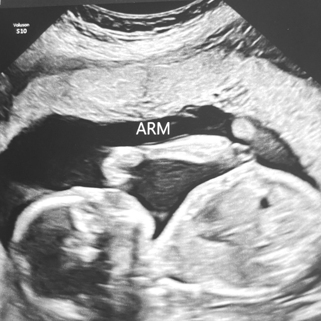 Photo shared by Clarissa for their Babylist baby registry.