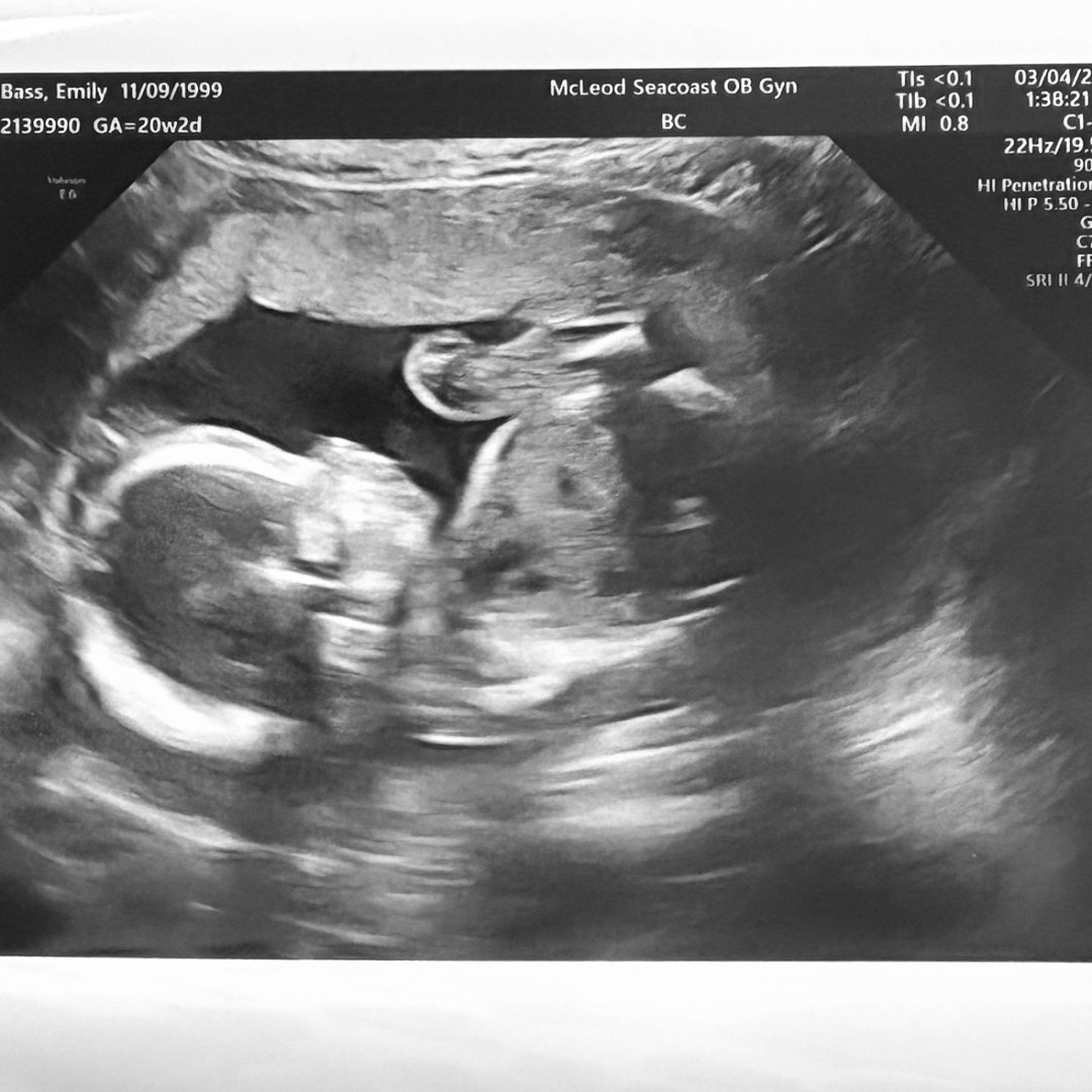 Photo shared by Emily for their Babylist baby registry.