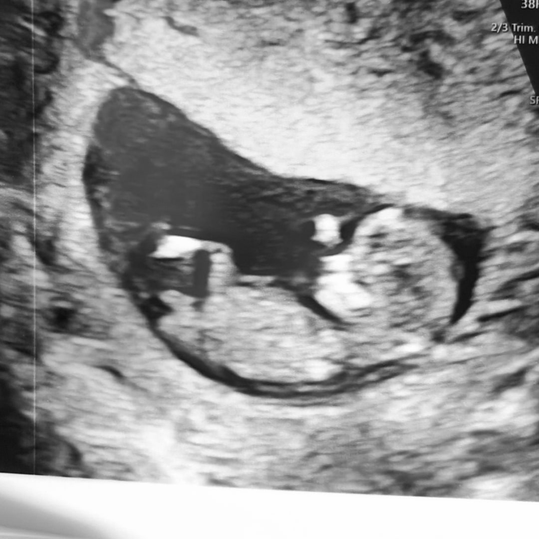 Photo shared by Emmy for their Babylist baby registry.
