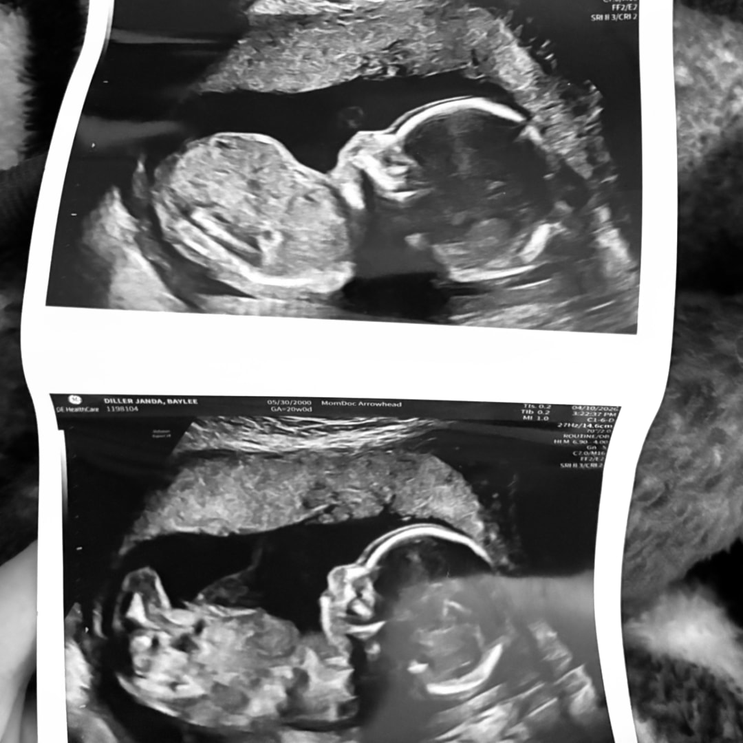 Photo shared by Baylee for their Babylist baby registry.