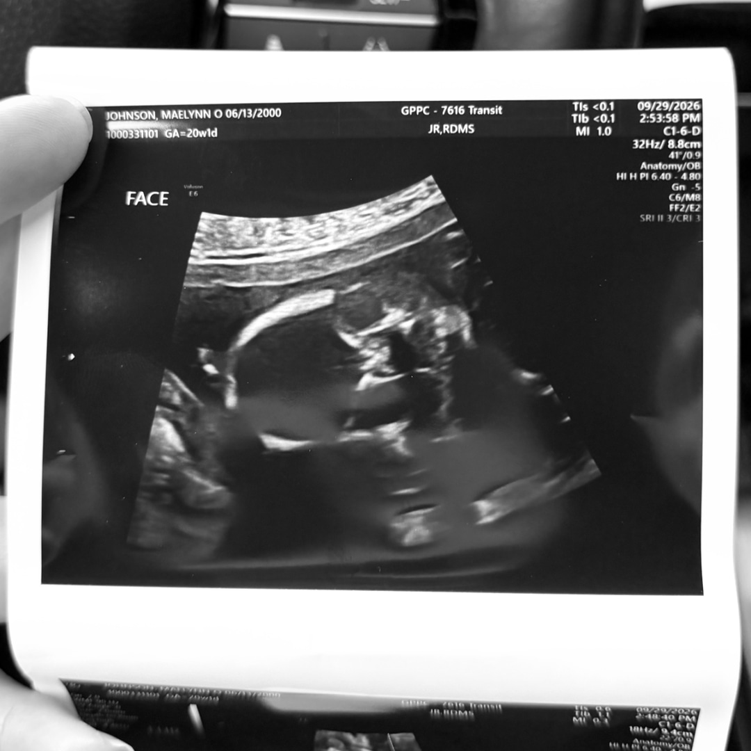 Photo shared by Maelynn for their Babylist baby registry.