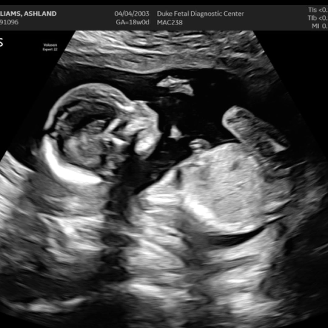 Photo shared by ASHLAND for their Babylist baby registry.