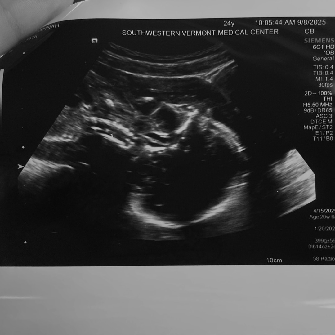 Photo shared by Hannah for their Babylist baby registry.