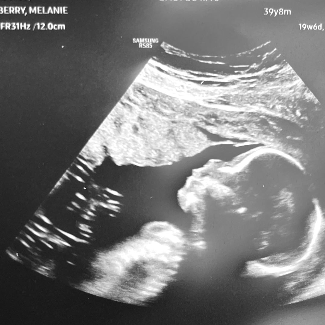 Photo shared by Melanie for their Babylist baby registry.