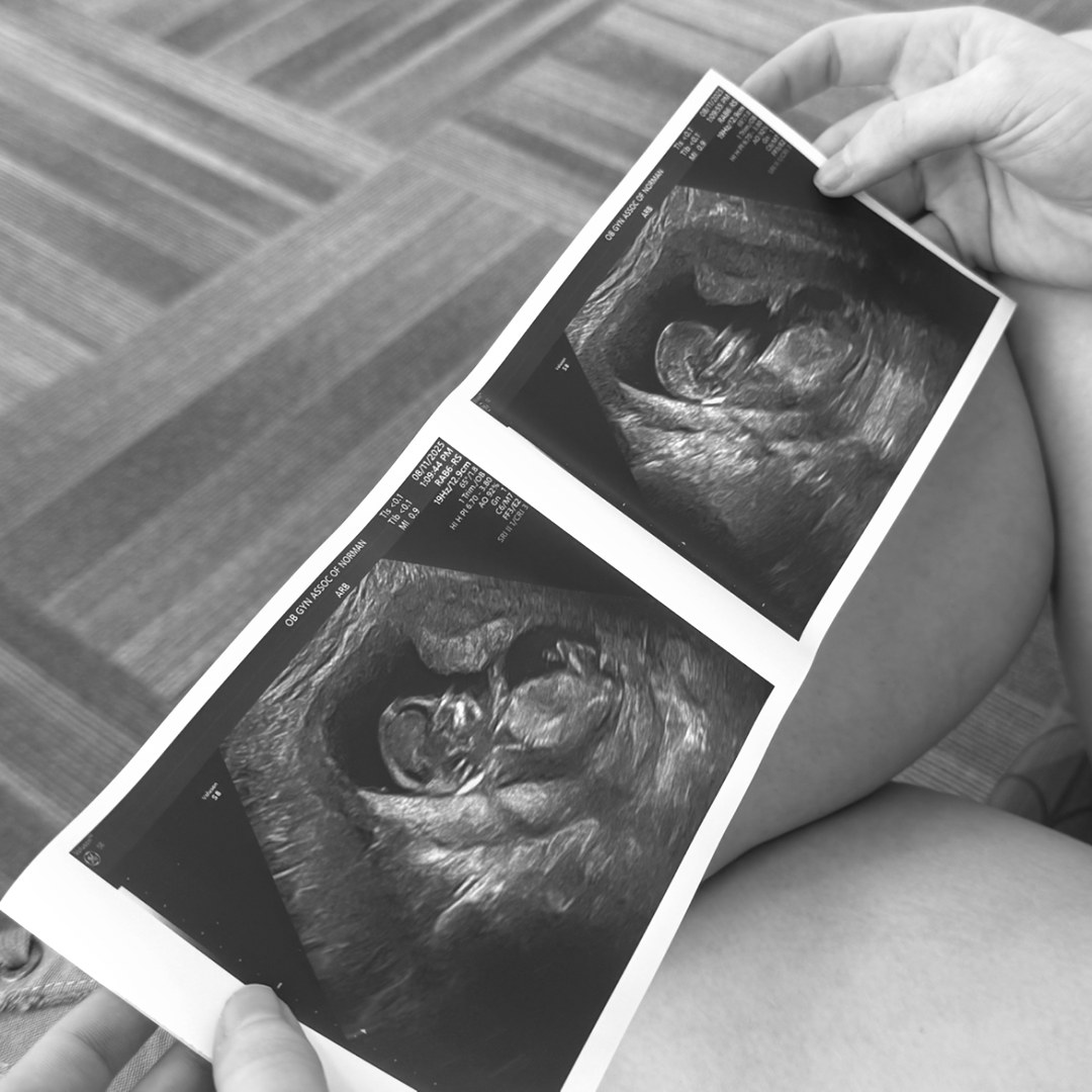 Photo shared by Destiny for their Babylist baby registry.