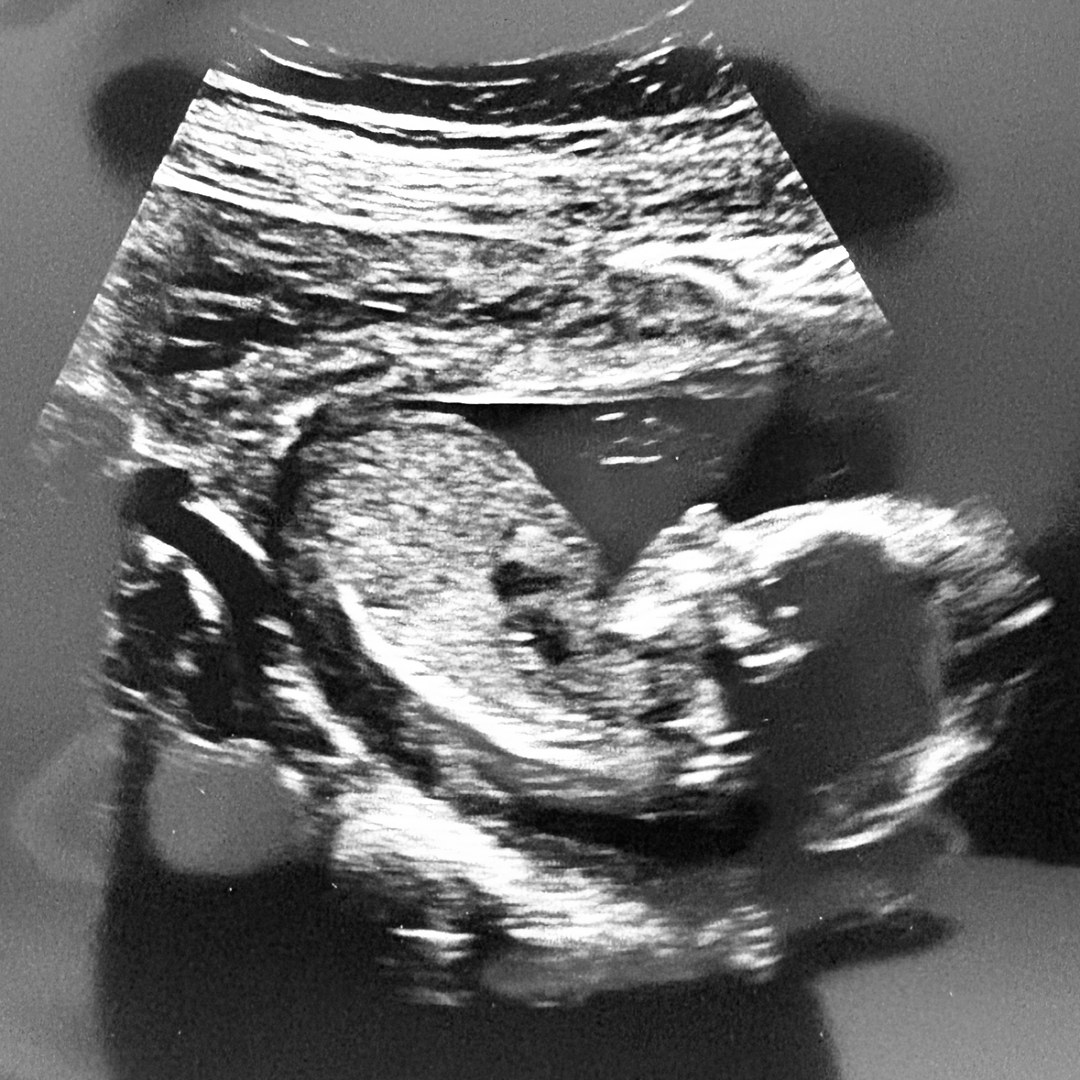 Photo shared by Laura for their Babylist baby registry.