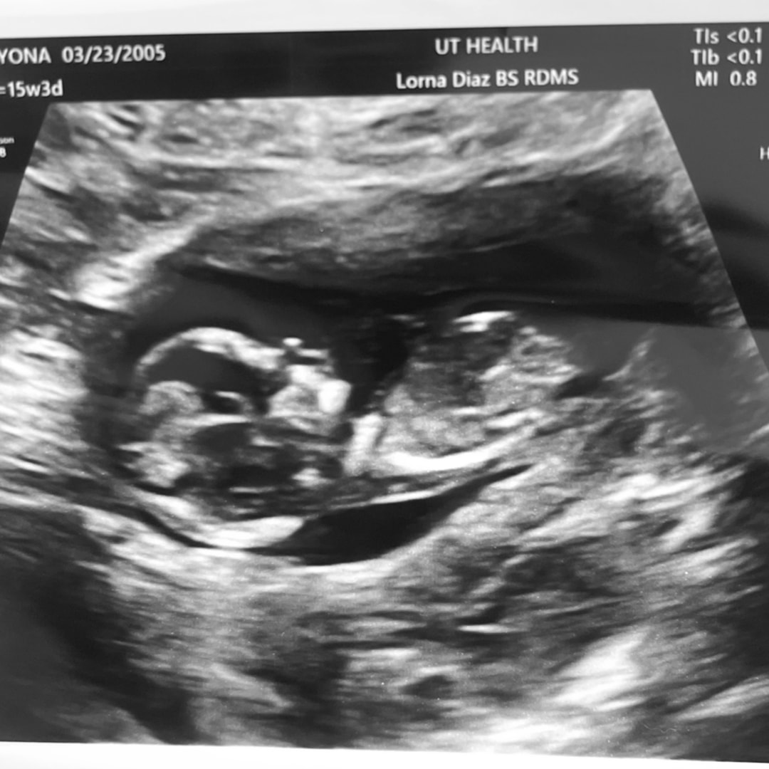 Photo shared by Bryona for their Babylist baby registry.