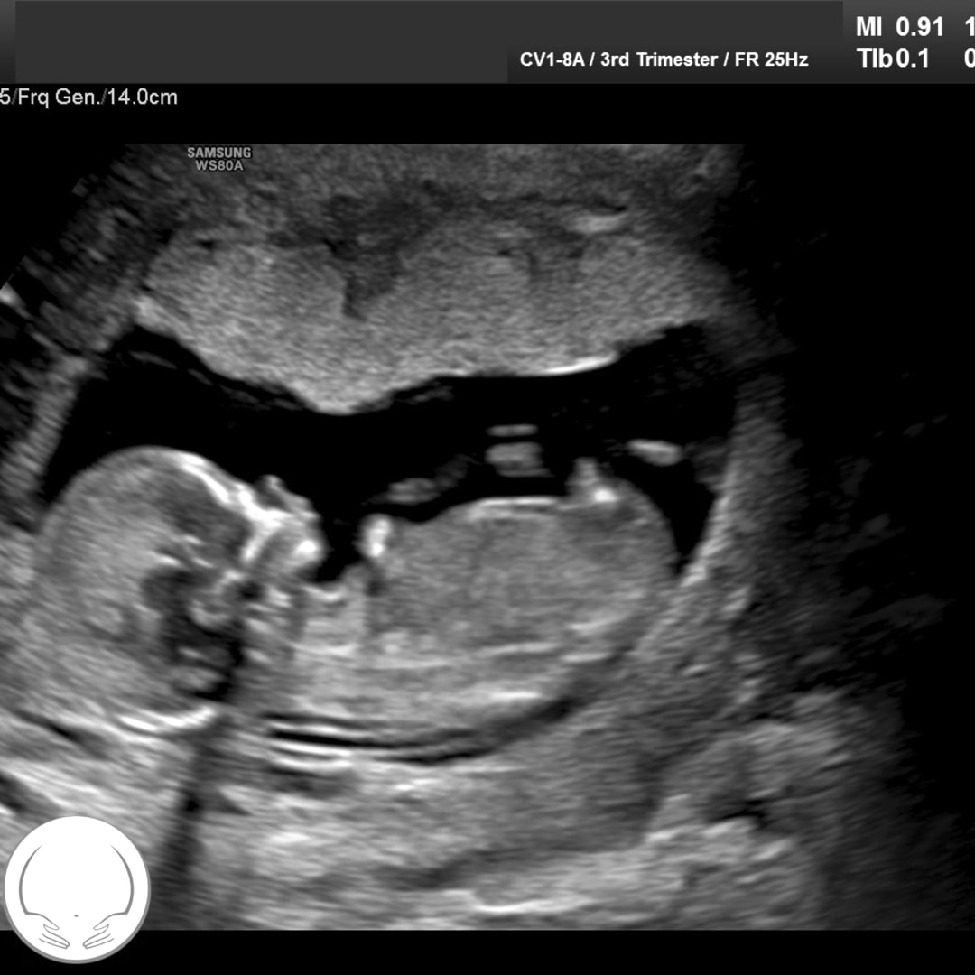 Photo shared by Jade for their Babylist baby registry.