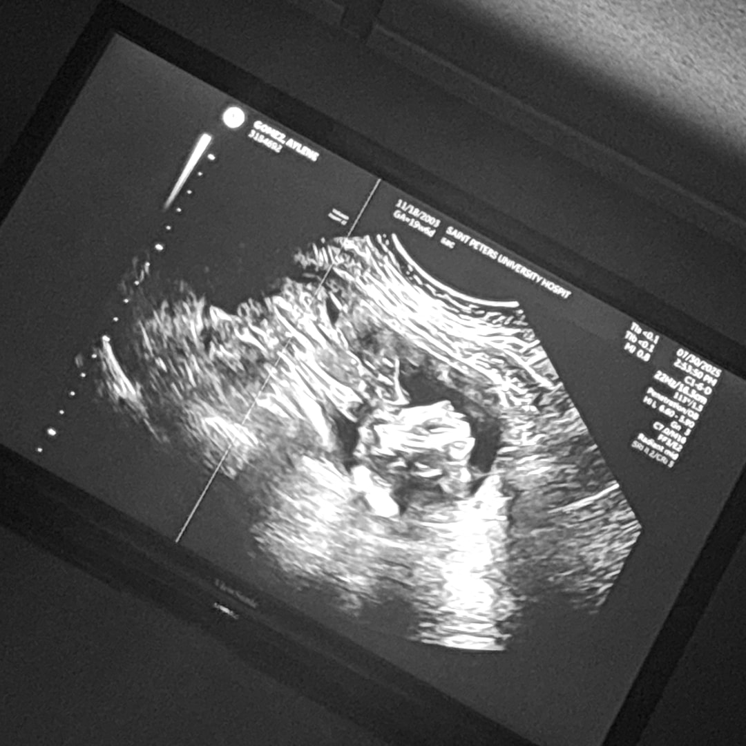 Photo shared by Aylene for their Babylist baby registry.