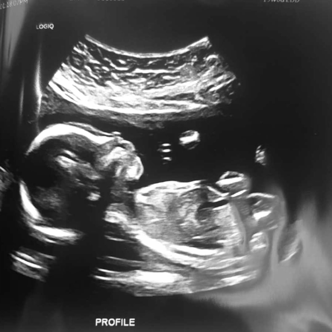 Photo shared by Brooklyn for their Babylist baby registry.