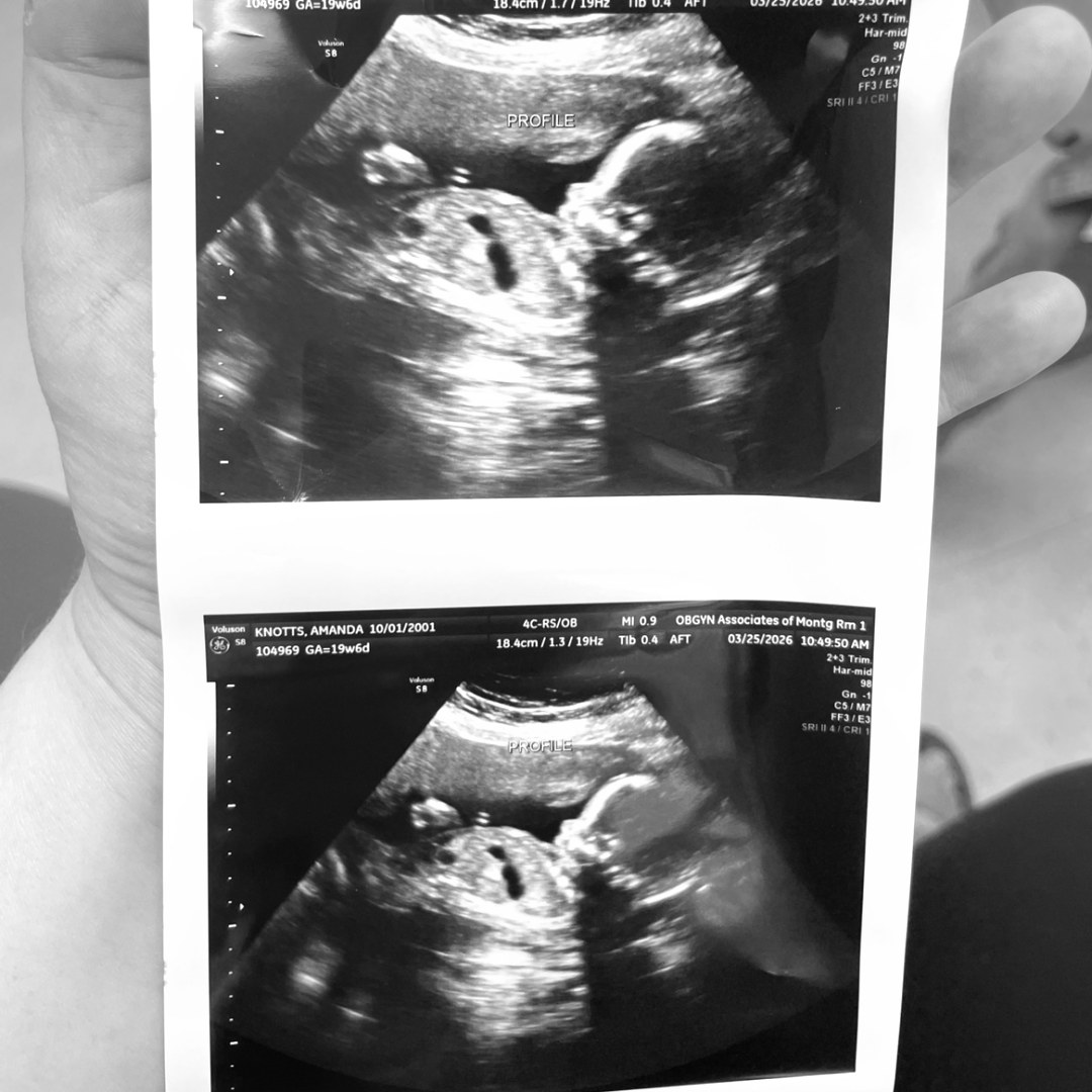 Photo shared by Amanda for their Babylist baby registry.