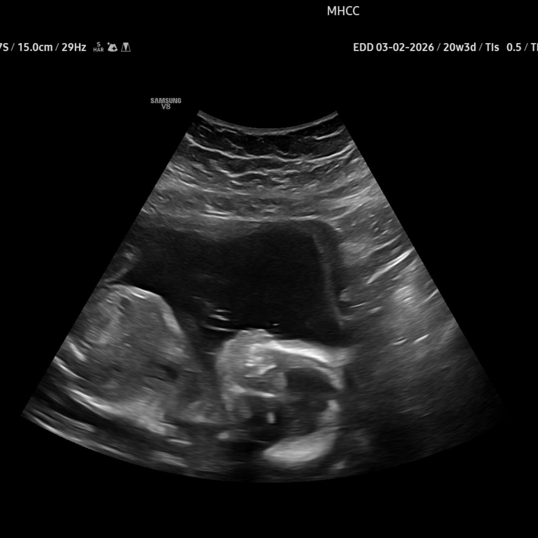 Photo shared by Bailey for their Babylist baby registry.