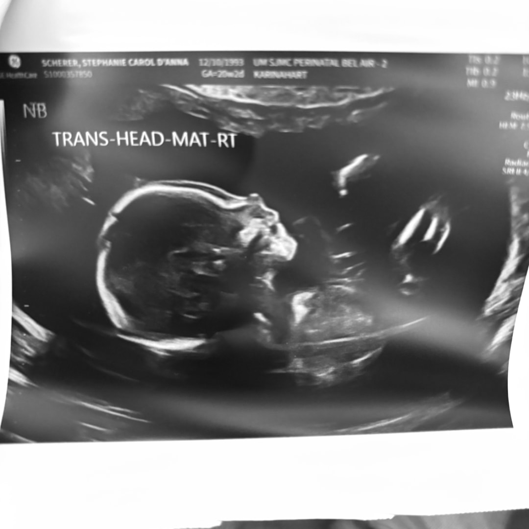 Photo shared by Stephanie for their Babylist baby registry.