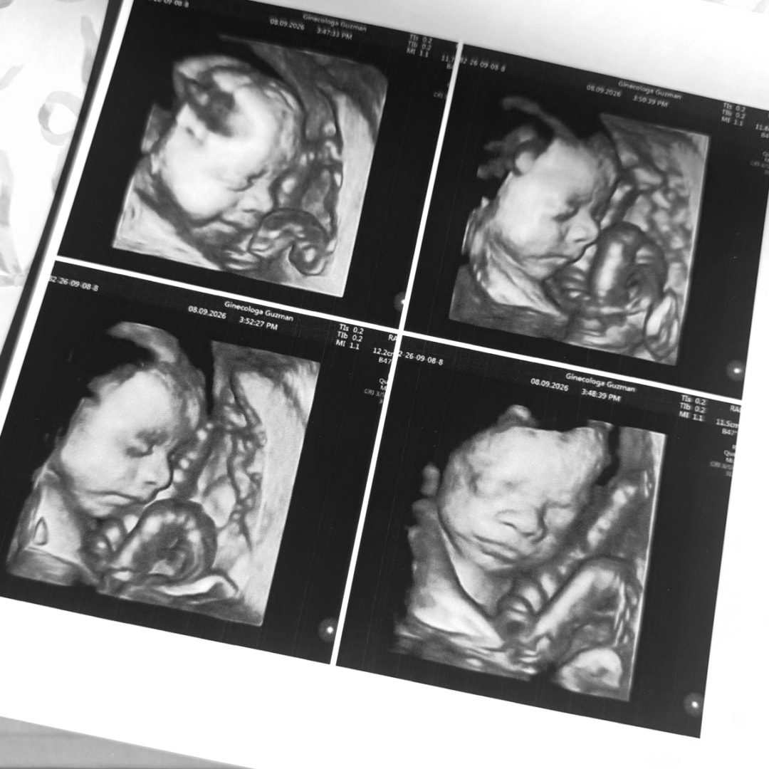 Photo shared by Sara for their Babylist baby registry.