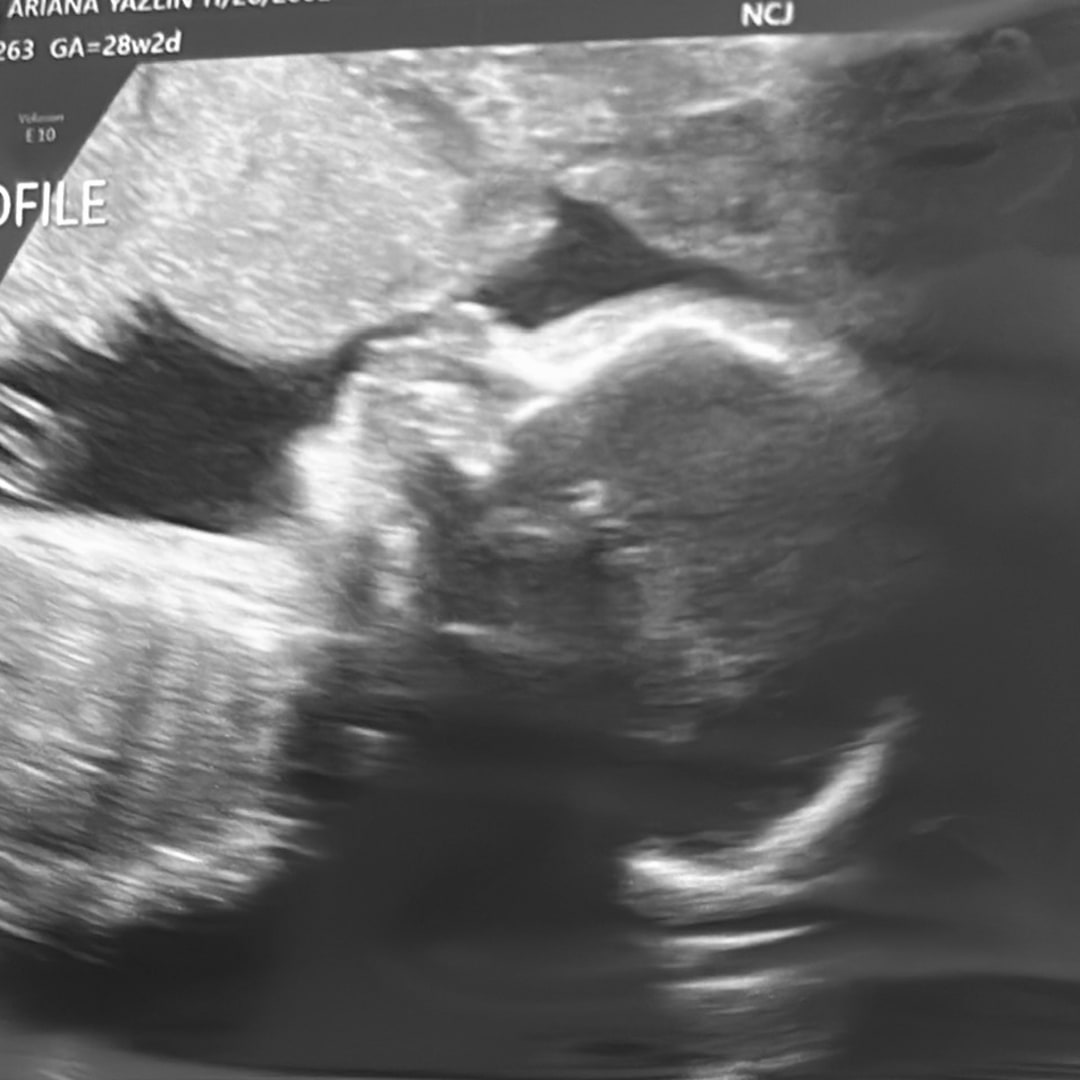Photo shared by Ariana for their Babylist baby registry.