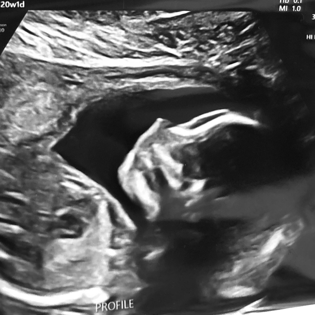 Photo shared by Autumn for their Babylist baby registry.