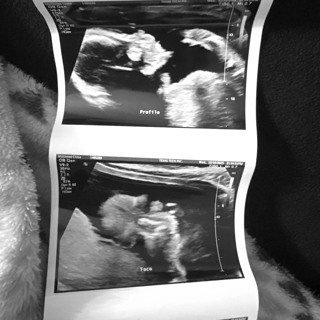 Photo shared by Chloe for their Babylist baby registry.