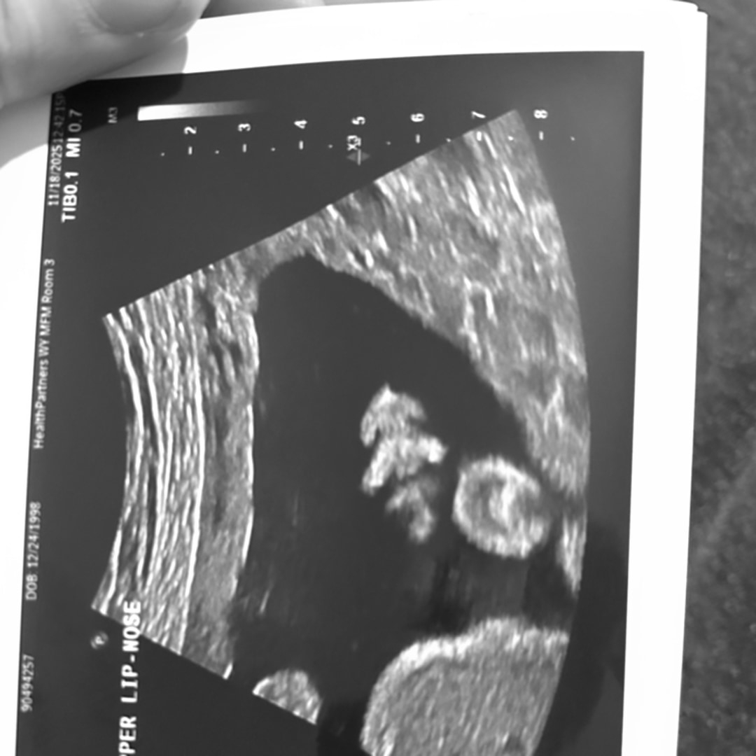 Photo shared by Alaina for their Babylist baby registry.