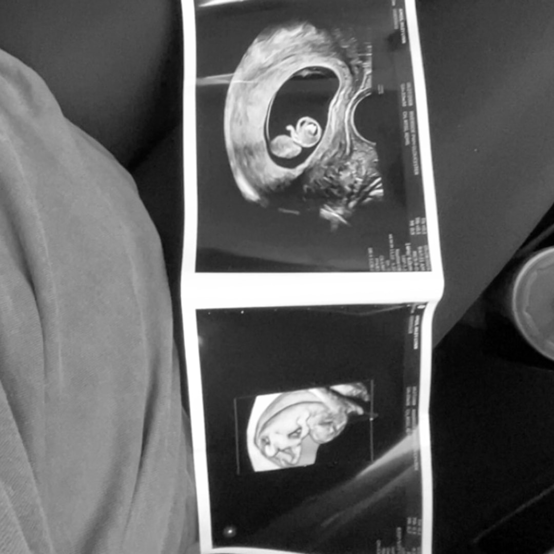 Photo shared by Riley for their Babylist baby registry.