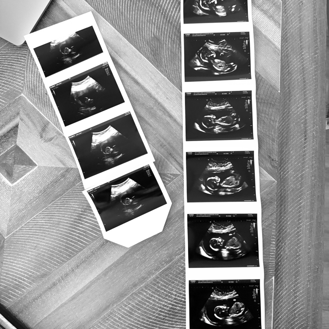 Photo shared by Alexandra for their Babylist baby registry.