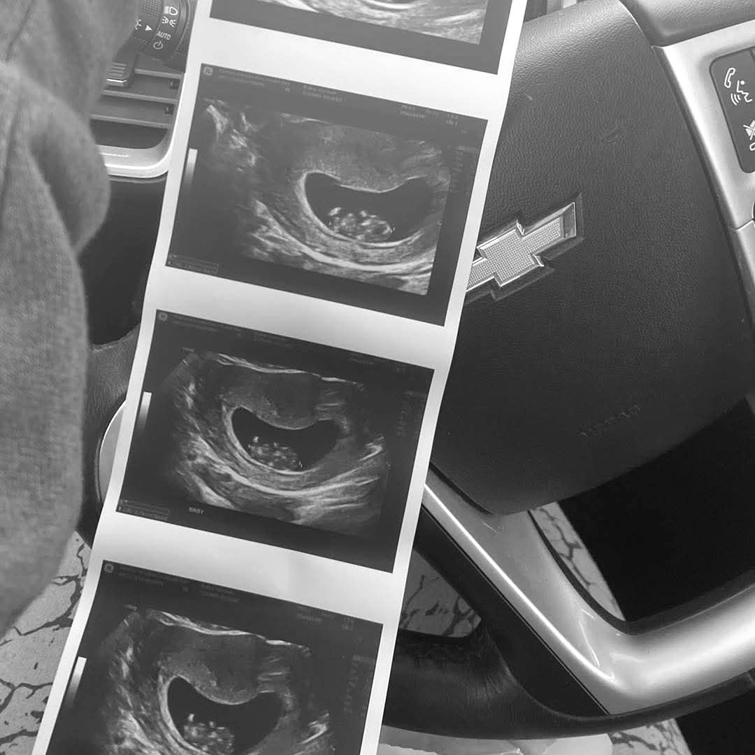 Photo shared by Hannah for their Babylist baby registry.