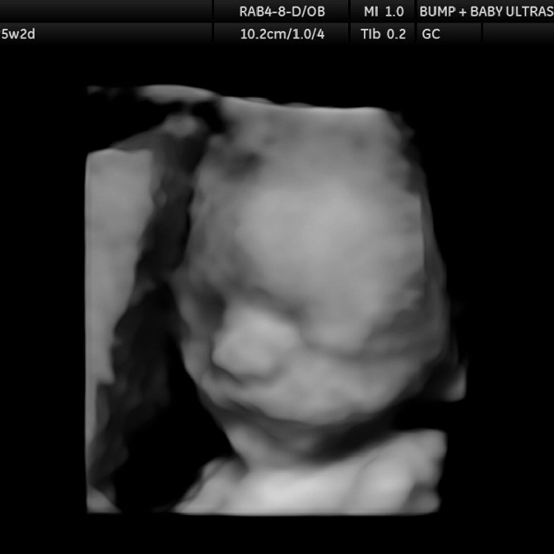 Photo shared by Hannah for their Babylist baby registry.