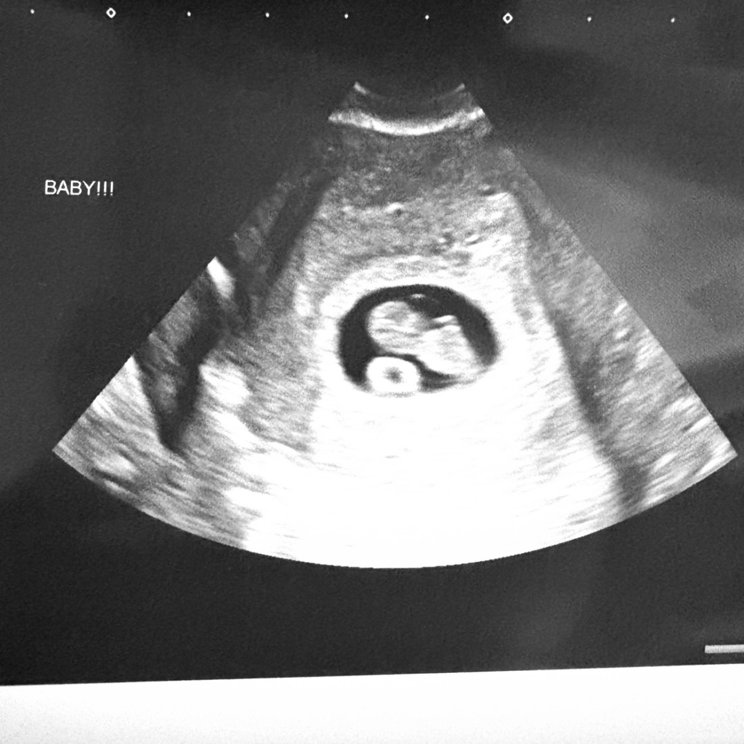 Photo shared by Yailyn for their Babylist baby registry.