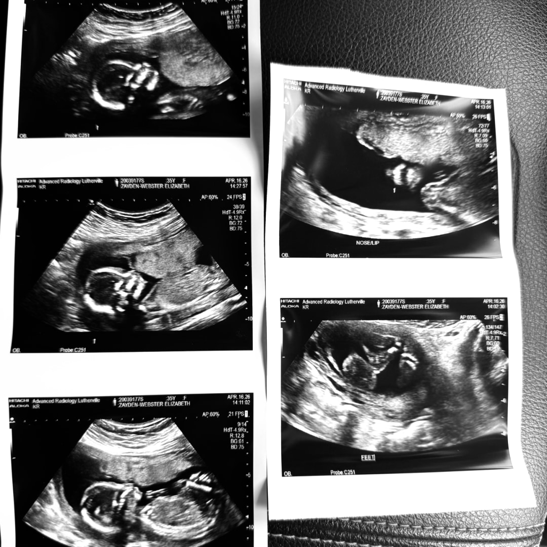 Photo shared by Elizabeth for their Babylist baby registry.