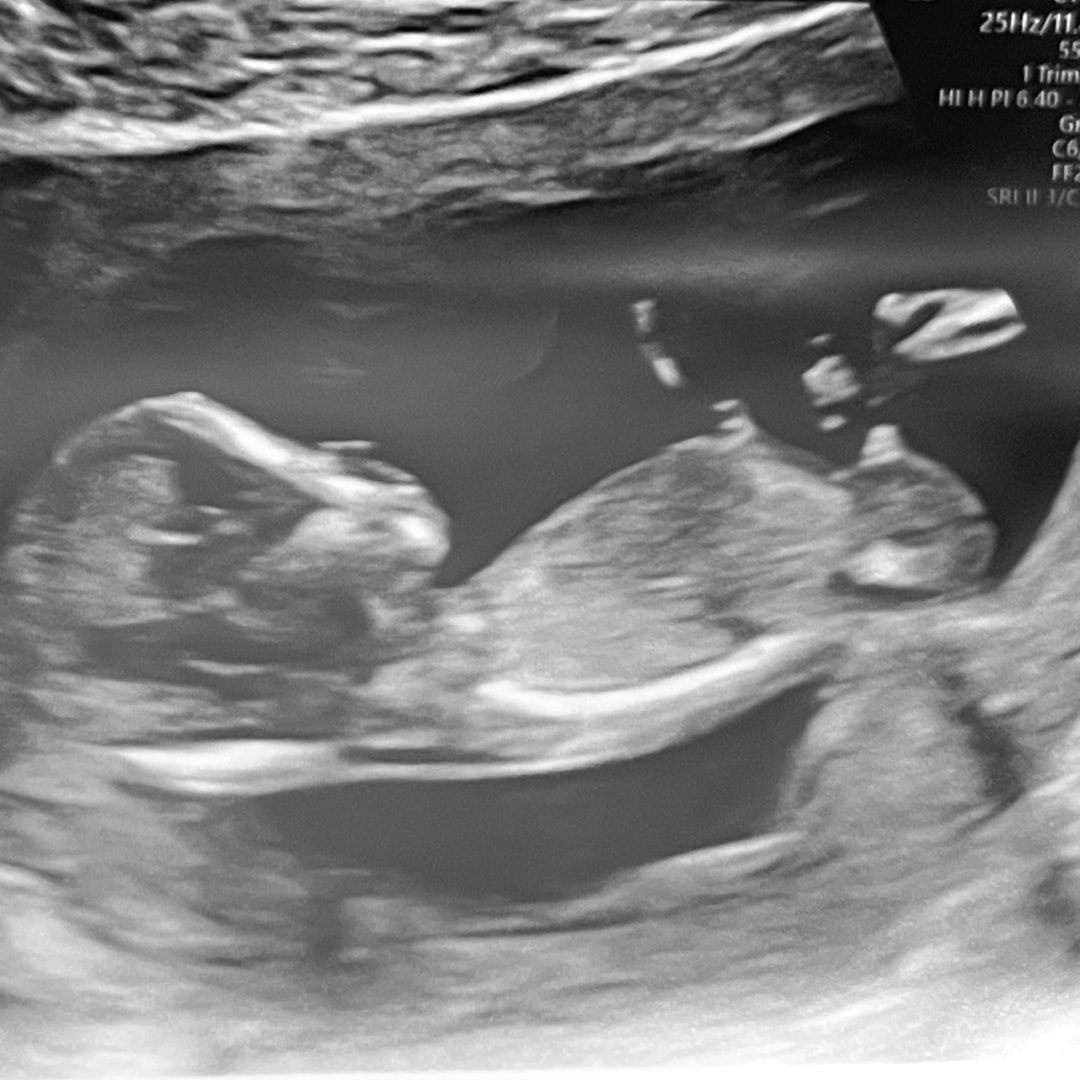 Photo shared by Amy for their Babylist baby registry.