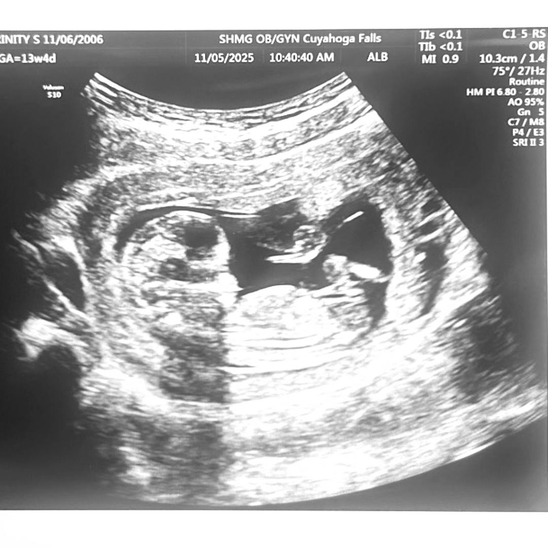 Photo shared by Trinity for their Babylist baby registry.