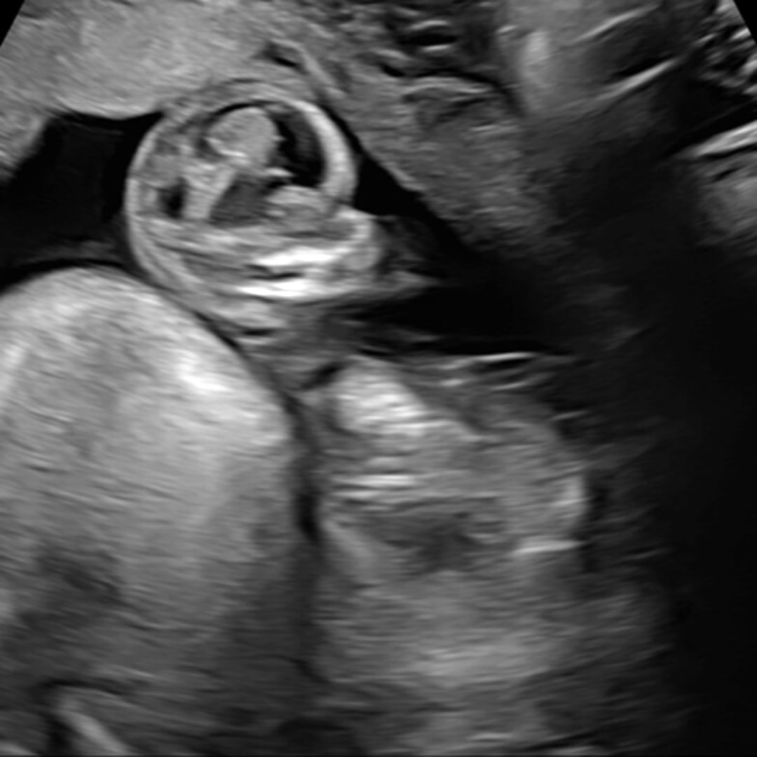 Photo shared by Emma for their Babylist baby registry.