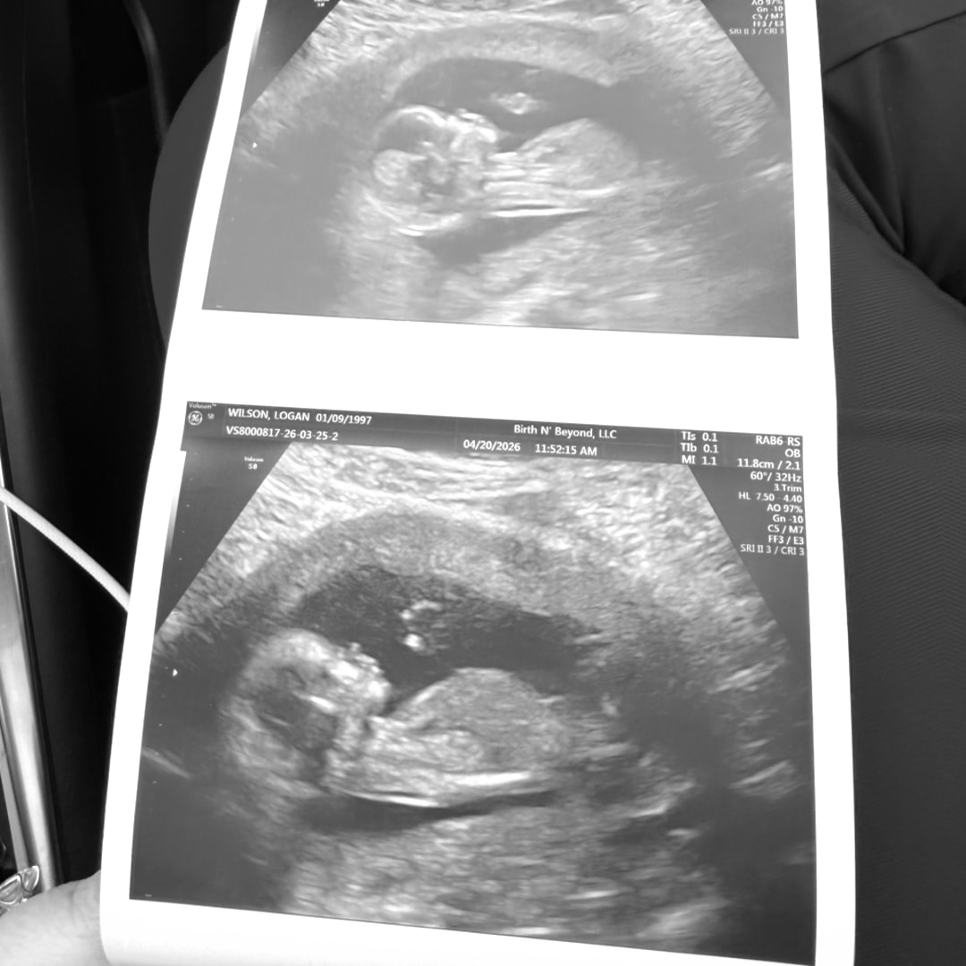 Photo shared by Logan for their Babylist baby registry.