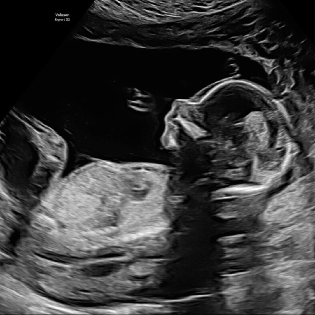 Photo shared by Danielle for their Babylist baby registry.