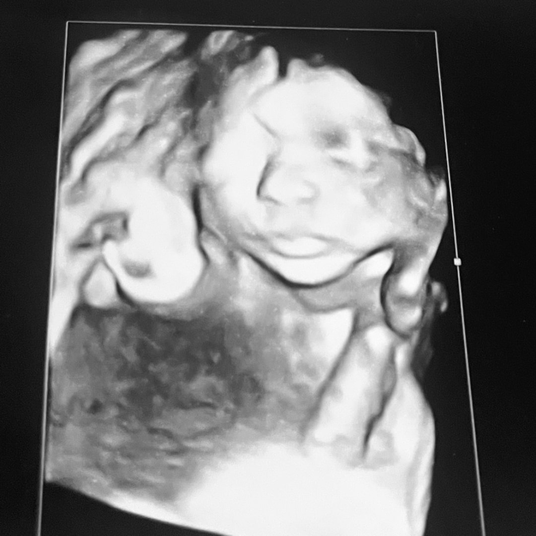 Photo shared by Denise for their Babylist baby registry.